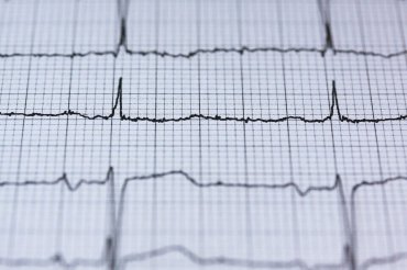 Was ist Herzratenvariabilität? 